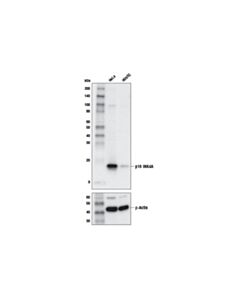 Cell Signaling P16 Ink4a (D3w8g) Rabbit mAb