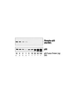Cell Signaling Phospho-P53 (Ser392) Antibody