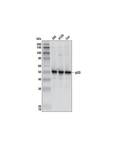 Cell Signaling P53 Antibody