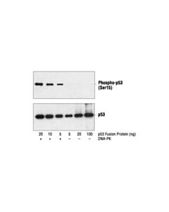 Cell Signaling Phospho-P53 (Ser15) Antibody