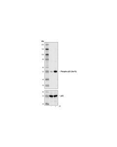 Cell Signaling Phospho-P53 (Ser15) (16g8) Mouse mAb