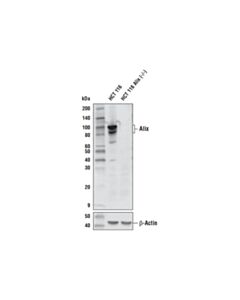 Cell Signaling Alix (E6p9b) Rabbit mAb