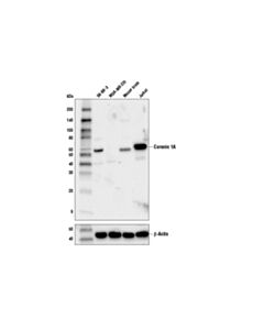 Cell Signaling Coronin 1a (D6k5b) Xp Rabbit mAb
