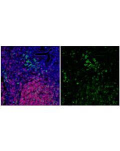Cell Signaling TACI/TNFRSF13B/CD267 (E3P6X) Rabbit mAb 20 uL