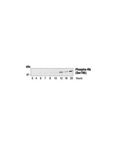 Cell Signaling Phospho-Rb (Ser795) Antibody