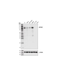Cell Signaling Mtss1 (D2h4l) Xp Rabbit mAb