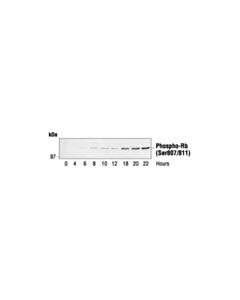 Cell Signaling Phospho-Rb (Ser807/811) Antibody