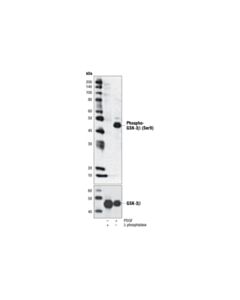 Cell Signaling Phospho-Gsk-3beta (Ser9) (5b3) Rabbit mAb