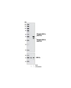Cell Signaling Phospho-Gsk-3alpha/Beta (Ser21/9) (37f11) Rabbit mAb (Gsk-3alpha Preferred)