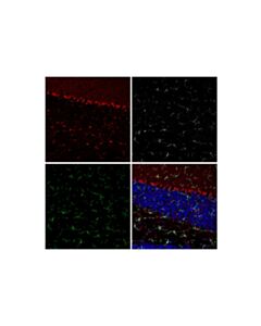 Cell Signaling S100B (E7C3A) Horse Chimeric mAb