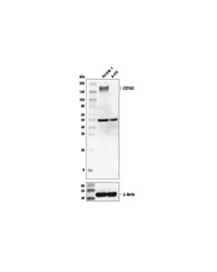 Cell Signaling Cd163 (D6u1j) Rabbit mAb