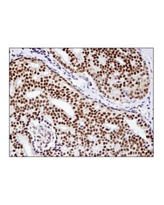 Cell Signaling Baf Complex Ihc Antibody Sampler Kit