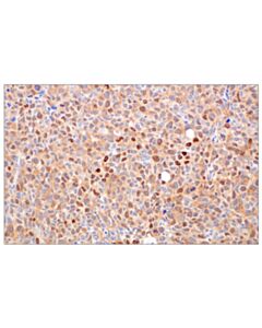 Cell Signaling CDK4 (F8L5F) Rabbit mAb