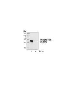 Cell Signaling Phospho-Stat5 (Tyr694) (C11c5) Rabbit mAb