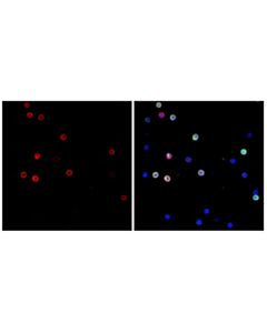 Cell Signaling CD162/PSGL-1 (F6N5G) Rabbit Monoclonal Antibody (IF Formulated)