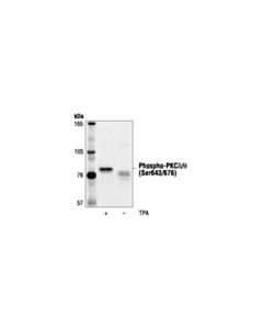 Cell Signaling Phospho-Pkcdelta/Theta (Ser643/676) Antibody