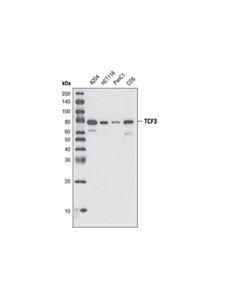 Cell Signaling Tcf/Lef Family Antibody Sampler Kit