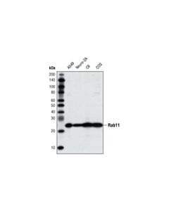 Cell Signaling Rab Family Antibody Sampler Kit