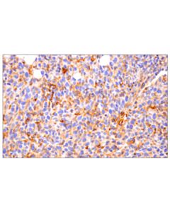 Cell Signaling CD14 (D1U2Y) Rabbit mAb 20 uL