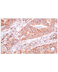 Cell Signaling PABP1 (F6G6L) Rabbit mAb