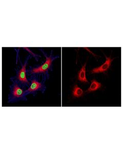 Cell Signaling Rab7 (D95f2) Xp Rabbit mAb (Alexa Fluor 647 Conjugate)