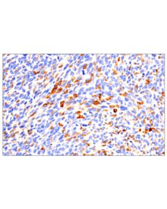 Cell Signaling CD22 (F9D1W) Rabbit mAb