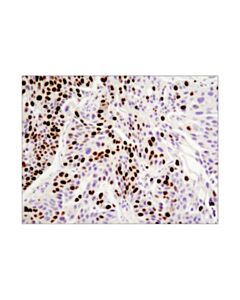 Cell Signaling Ki-67 (8d5) Mouse mAb