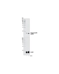 Cell Signaling Phospho-4e-Bp1 (Ser65) Antibody