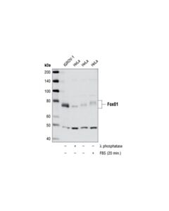 Cell Signaling Foxo1 (L27) Antibody