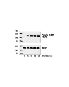 Cell Signaling Phospho-4e-Bp1 (Thr70) Antibody