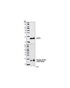 Cell Signaling Phospho-4e-Bp1 (Thr37/46) Antibody