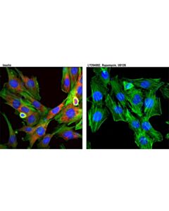 Cell Signaling Phospho-S6 Ribosomal Protein (Ser240/244) (D68f8) Xp Rabbit mAb (Alexa Fluor 594 Conjugate)