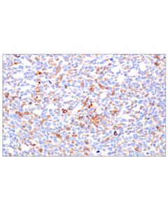 Cell Signaling TRAF5 (F6W4N) Rabbit mAb