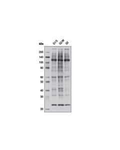 Cell Signaling Phospho-CDK Substrate Motif [(K/H)pSP] MultiMab Rabbit mAb mix 20 uL