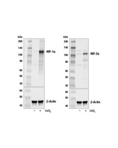 Cell Signaling Hif-1alpha/2alpha Control Cell Extracts