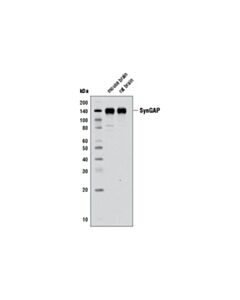 Cell Signaling SynGAP (D88G1) Rabbit mAb 20 uL