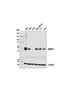Cell Signaling Ndrg1 (D8g9) Xp Rabbit mAb