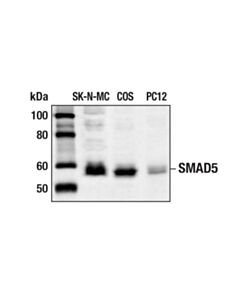 Cell Signaling Smad5 Antibody