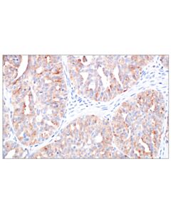 Cell Signaling CD205/DEC-205 (F8Q9S) Rabbit mAb