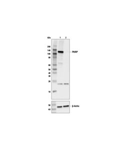 Cell Signaling Parp (46d11) Rabbit mAb
