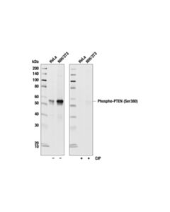Cell Signaling Phospho-Pten (Ser380/Thr382/383) (44a7) Rabbit mAb