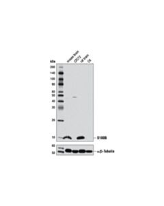 Cell Signaling S100B (D10G6) Rabbit mAb 20 uL