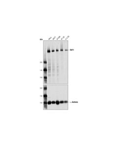 Cell Signaling Rif1 (D2f2m) Rabbit mAb