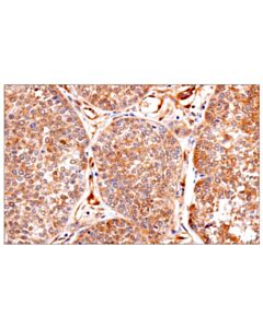 Cell Signaling Pten (138g6) Rabbit mAb