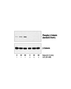 Cell Signaling Phospho-Beta-Catenin (Ser33/37/Thr41) Antibody