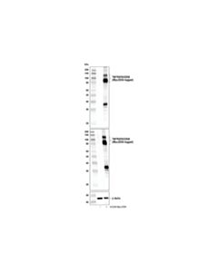 Cell Signaling Tnfrsf8/Cd30 (E1a6y) Rabbit mAb