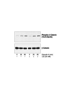 Cell Signaling Phospho-Beta-Catenin (Thr41/Ser45) Antibody