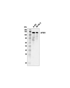 Cell Signaling Ap3b1 (E7u2p) Rabbit mAb