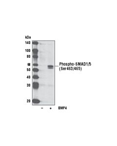 Cell Signaling Phospho-Smad1/5 (Ser463/465) (41d10) Rabbit mAb (Biotinylated)