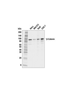 Cell Signaling Beta-Catenin (6b3) Rabbit mAb